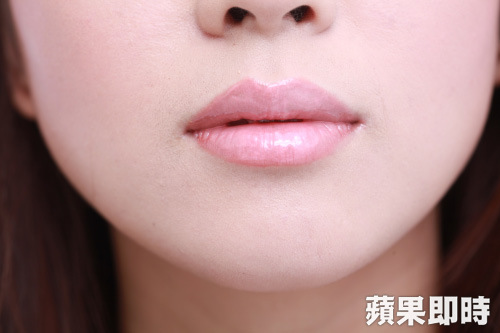 不少女性渴望擁有豐厚性感的嘴唇。資料照片